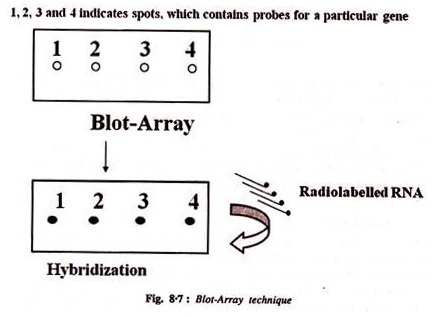 Modern Imaging Techniques of Brain