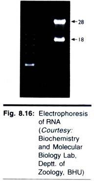 Free (a) and attached (b,c,d) ribosomes