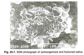 The major classes of human antibodies