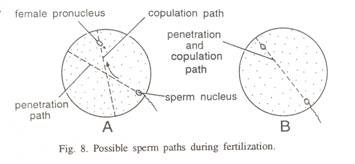 Diagrammatic representation of the Section through Cerebral Hemisperes, Brain Stem and Spinal Cord