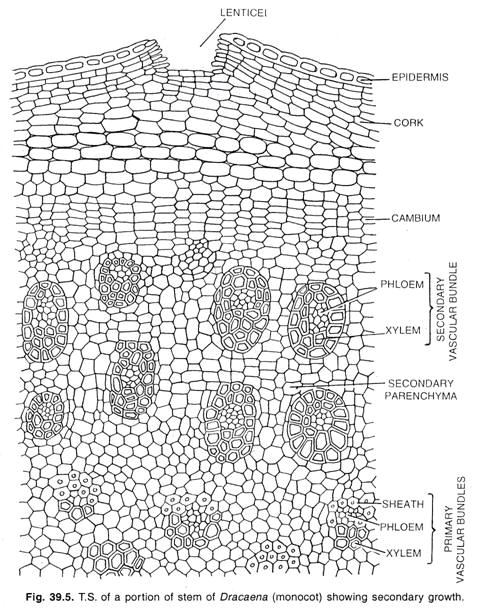 T.S. of a portion of stem of Dracaena