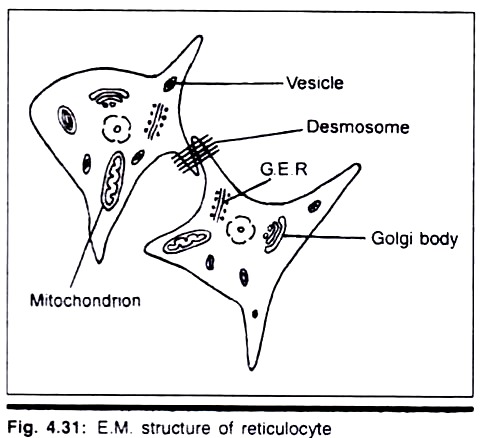 E.M. Structure of Reticulocyte