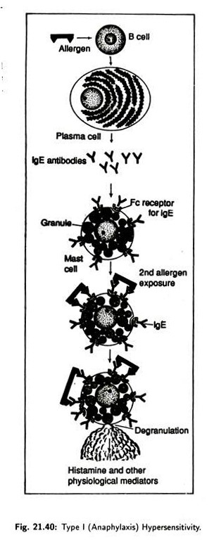 Type I (anaphylaxis) Hypersensitivity