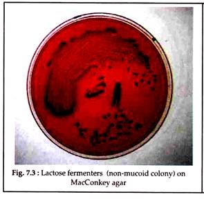 Lactose Fermenters on MacConkey Agar