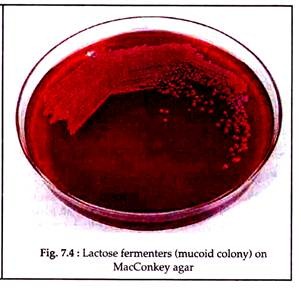 Lactose Fermenters on MacConkey Agar