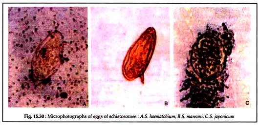 Microphotographs of Eggs of Schistosomes