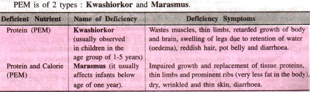 Kwashiorkor and Marasmus