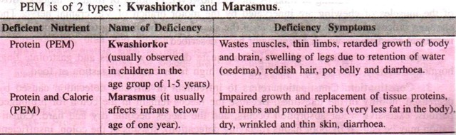 Kwashiorkor and Marasmus