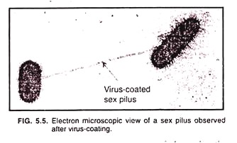 Electron microscopic view of a sex pilus observed after virus-coating