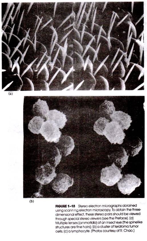 Variations in the Sporangial Development