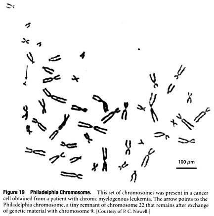 Philadelphia Chromosome